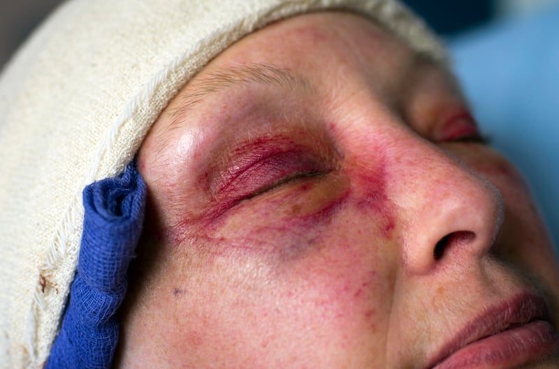 how-to-choose-the-right-brain-injury-lawyer-in-ontario