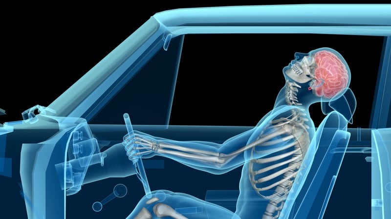 What Does a Spinal Cord Injury Lawyer Actually Do